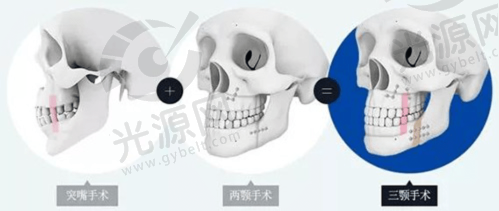 2. 泰国咖蒙(KAMOL)整形医院