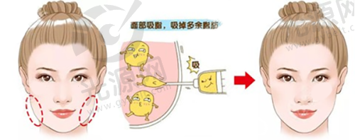 3. 太原华美整形美容医院 - 大型正规医院
