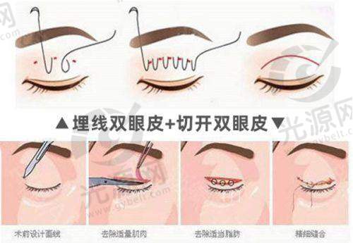 交替治疗的成效与适应症