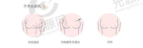二、深圳罗湖盛美佳整形医院：手术项目与技术优势