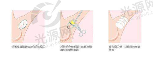 三、韩国拉斐安整形医院的客户实例分享