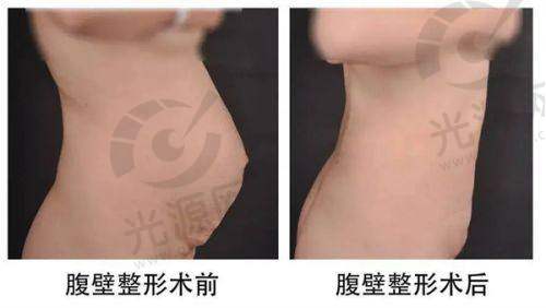 总结