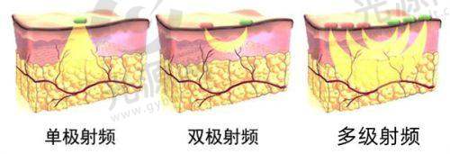 一、浙江省省人民医院美容科详细介绍