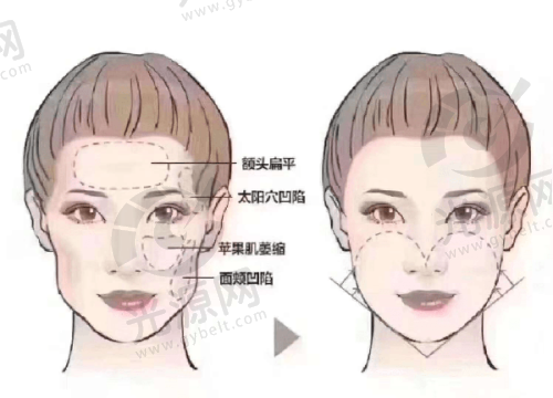 一、韩国全脸整容榜单前十名单