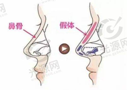 三、国内前十名的整形医院哈尔滨道里区哪个整容院能种眉每家医院的详细介绍