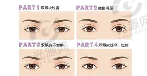 术后成效及修复周期