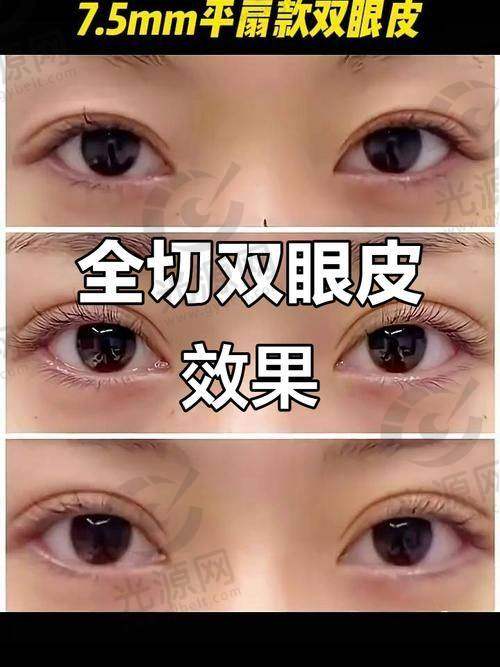 一、沈阳百嘉丽医疗美容医院——眼部整形之翘楚