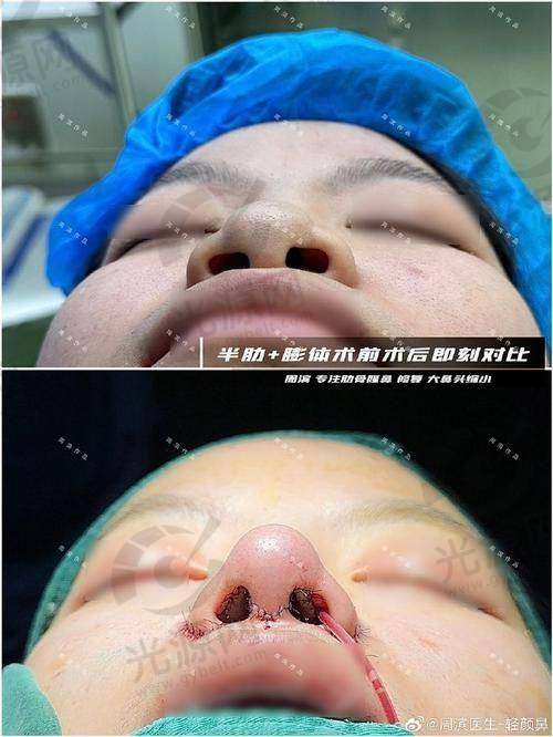 四、广尔美丽医院在哪里？