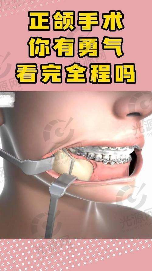 正颌手术毁我一辈子：选择医生的重要性