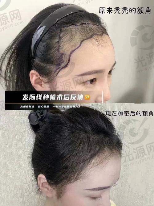 三、患者反馈与真实实例分享