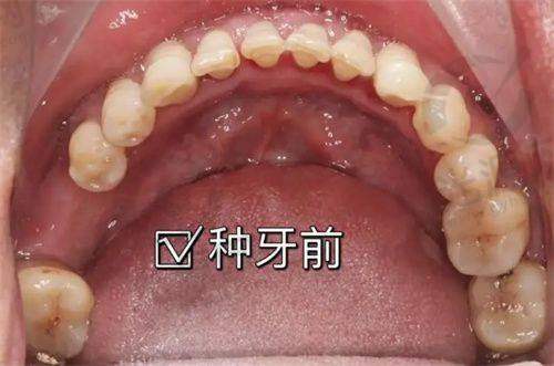 在线弹窗预约