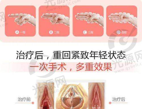 菲密丽仪器做一次多少钱与行业口碑的反映