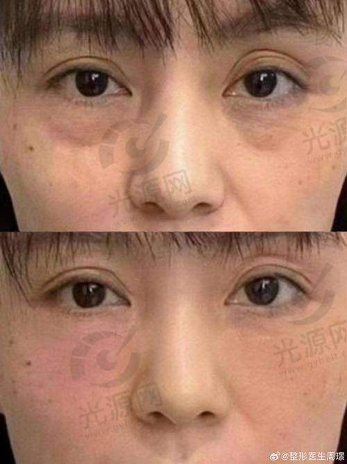 总结与展望