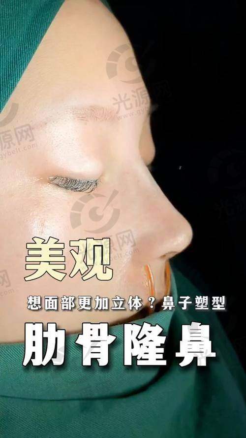 总结肋骨鼻3年鼻尖突然出现了白点是否穿孔？