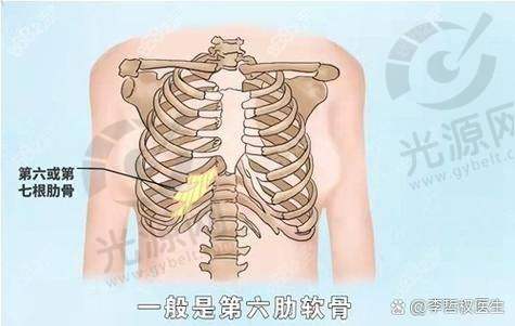 肋骨鼻材料选择与鼻尖发白的关联性