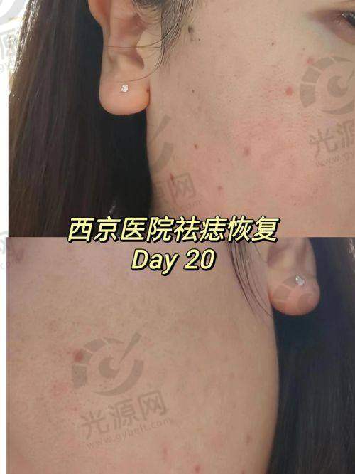 五、预约挂号攻略