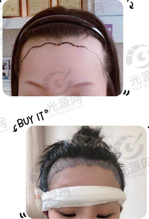 8. 深圳阳光美容医院植发科