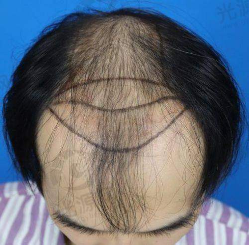 总结