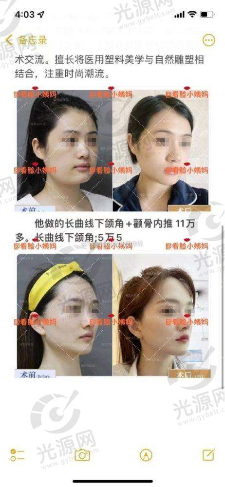 患者反馈：曹栋弼医生的口碑如何？