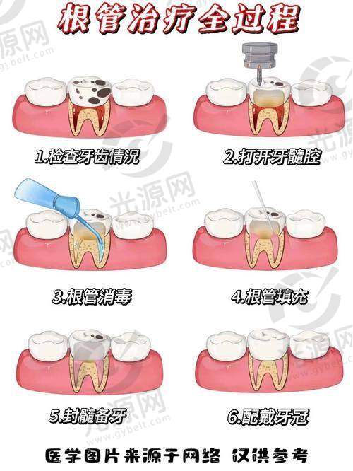 2. 牙齿矫正费用解析