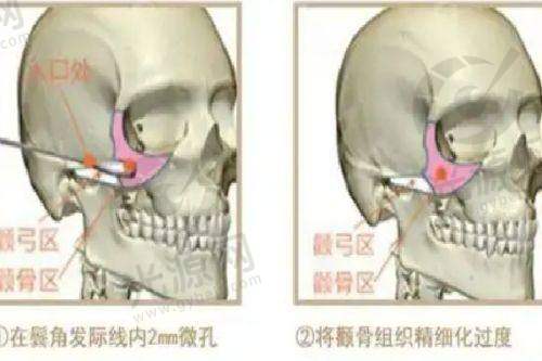 四、上海美立方整形医院在哪里?详细医院地址与情况