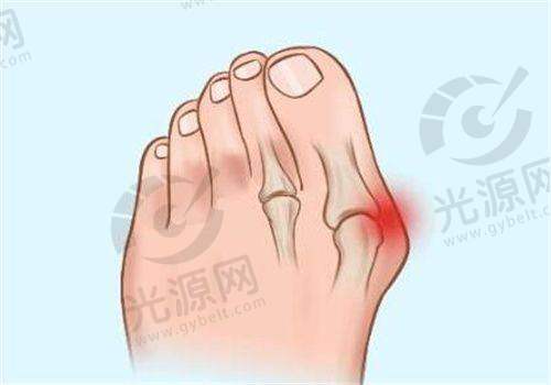 三、北京画美整形医院的真实口碑实例分享