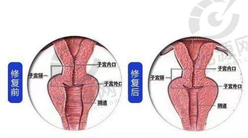 五、四川友谊医院整形外科的预约挂号攻略
