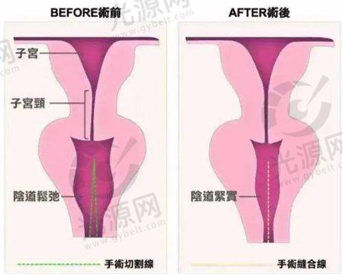 五十岁脸上的老年斑怎么去掉？五十岁女性必看：有效去除老年斑的实用方法与护理技巧分享