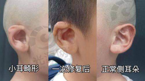 六、郑大一附院整形科价格明细