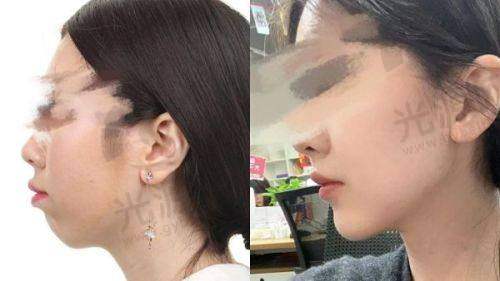 一、佳木斯美白整形医院怎么样？