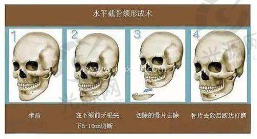 一、泰国康民医院概述：技艺不错，实力雄厚