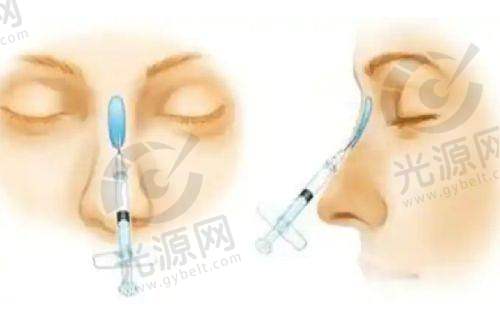 郭伶俐鼻综合:专精背景与特色技术
