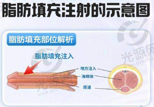 3. 泰国康民整容医院