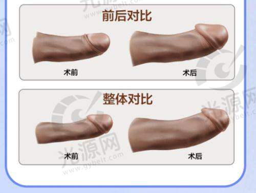 三、开州人民医院医美口碑如何？看实例分享
