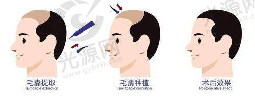 二、湖州九八医院整形科擅长项目及技术优势