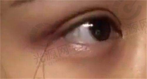 五十岁女性应调整生活方式