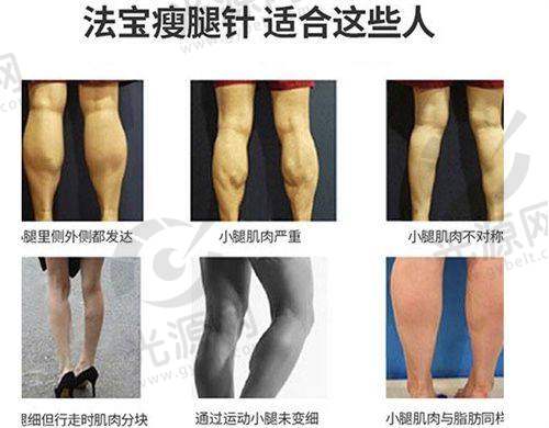 三、邢台伊美的患者评价实例