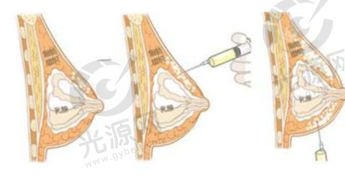三、北京整形美容医院的收费情况