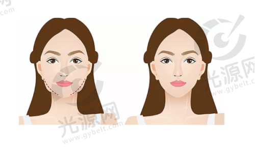 一、正规、专精的北京画美整形医院简析