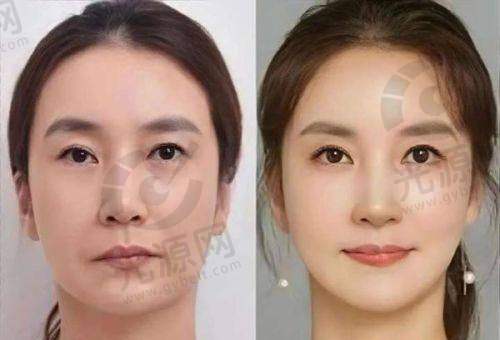 贵阳华美整形医院医生排行榜中的黄在弘