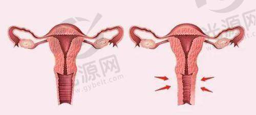2. 北京加减美医疗美容医院:面部若隐若现的青春