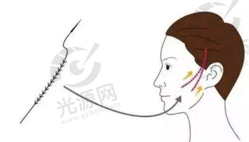 扬州黄蝉院长的真实实例