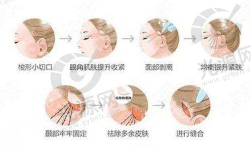 三、重庆整形项目收费情况