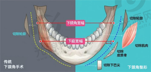 三、深圳利美康西一诺口碑如何,分享真实评价