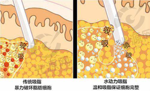 四、佛山佳丽整形医院位置介绍
