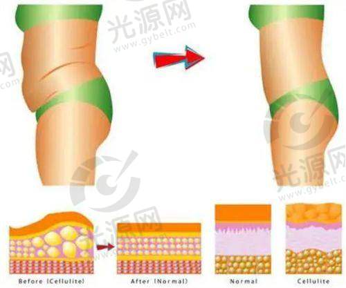 五十岁女性应加强维生素E的摄入