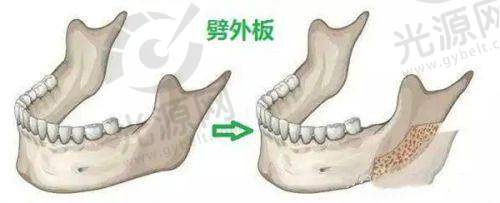 一、广州韩式千玺医疗美容怎么样