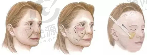 一、成都纽莱茵整形医院怎么样