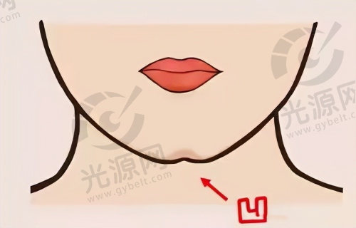 如何预约贵阳华美整形医院的黄在弘