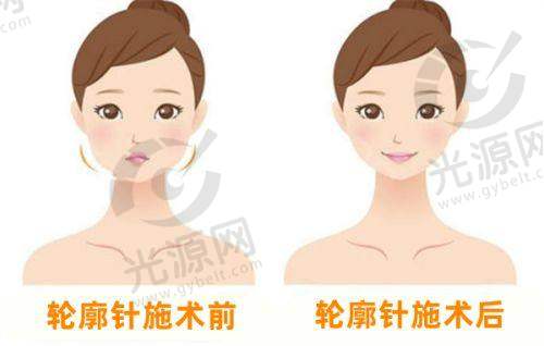 三、佳木斯美白整形医院患者口碑